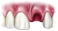 A sample image of a dental trauma