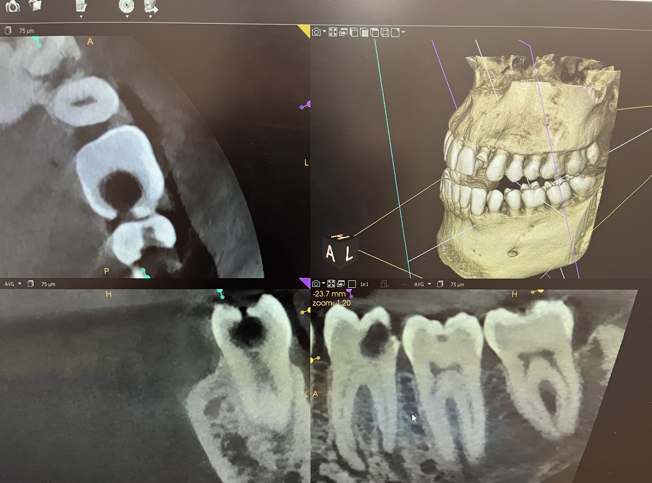 X-Ray Imaging- Patient Analysis