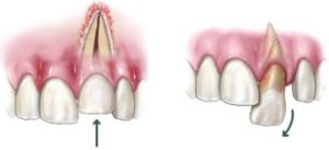A sample image of a dental trauma